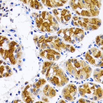 FASN / Fatty Acid Synthase Antibody
