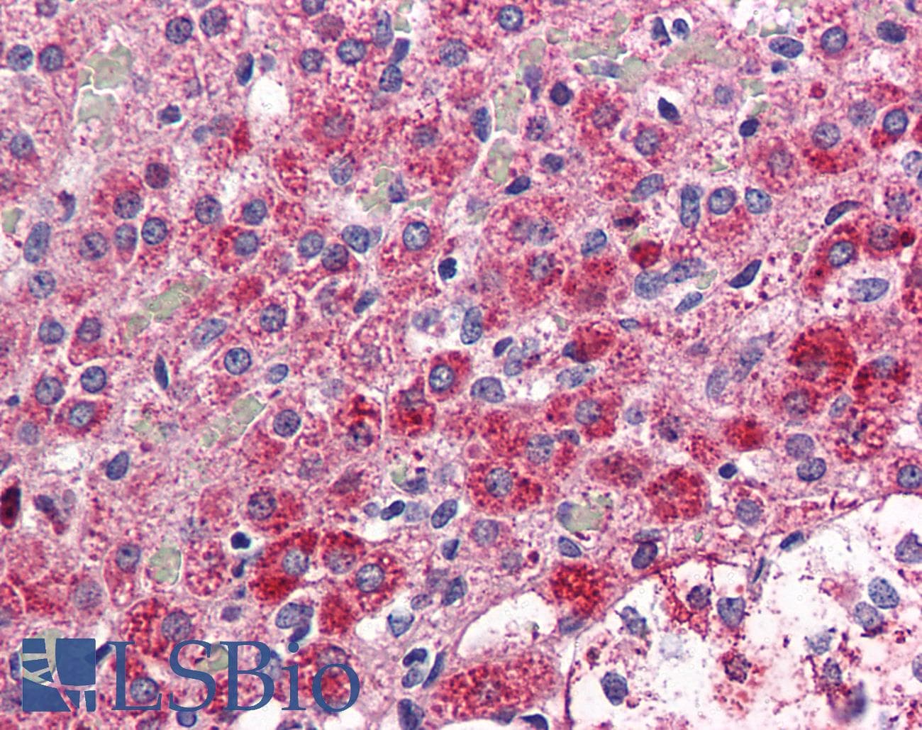 IHC-plus™ Polyclonal Rabbit anti-Human CCKAR / CCK1R Antibody (Internal, IHC)