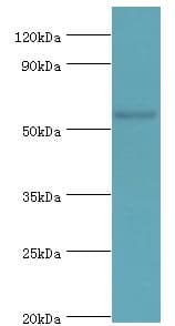 SRSF4 / SFRS4 Antibody (aa1-180)