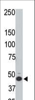 HTRA3 Antibody (aa112-144)