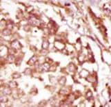 BUB1B / BubR1 Antibody (aa3-33)