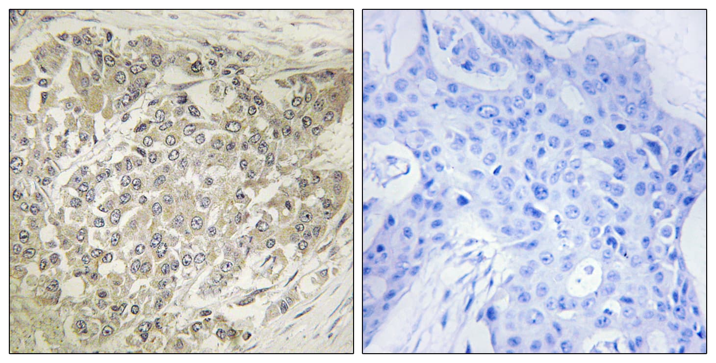 Polyclonal Rabbit anti-Human RPS6KB1 / P70S6K / S6K Antibody (aa414-463, IHC, WB)