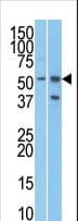 URI1 / NNX3 Antibody (aa347-376)