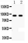 CDH17 / Cadherin 17 Antibody (aa686-699)