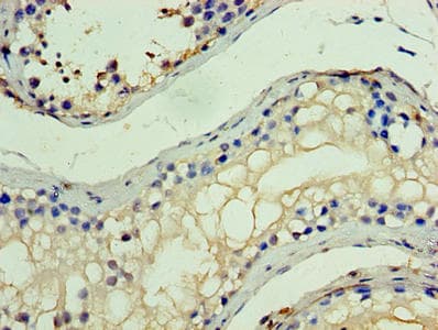 MYST2 / HBO1 Antibody