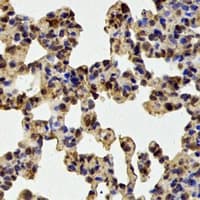 PSMA1 Antibody
