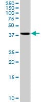 IHC-plus™ Monoclonal Mouse anti-Human RRM2 Antibody (clone 1E1, IHC, IF, WB)