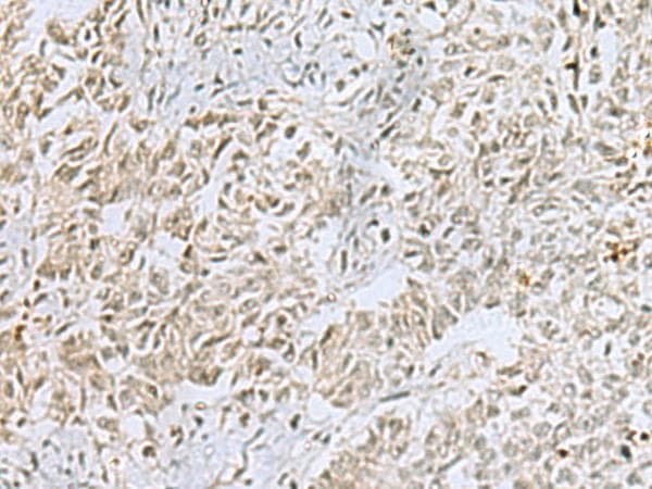Polyclonal Rabbit anti-Human FOXQ1 Antibody (IHC, WB)