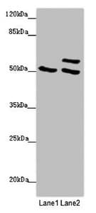 TUBB4 / Tubulin Beta 4 Antibody