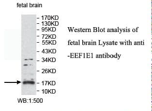EEF1E1 / AIMP3 Antibody (aa1-174)