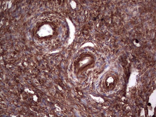 PKM2 Antibody (clone 1G10)