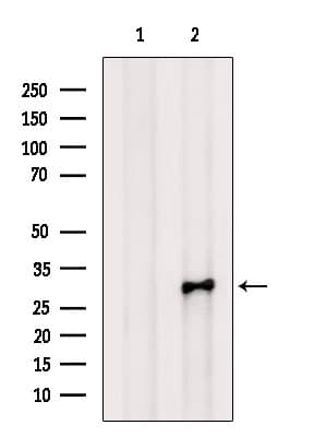 Polyclonal Rabbit anti-Human SNAP29 Antibody (WB)