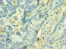 STX12 / Syntaxin 12 Antibody (aa1-250)