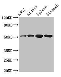 ALDH3B1 Antibody