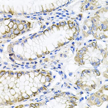 Polyclonal Rabbit anti-Human ACVR2 / ACVR2A Antibody (IHC, WB)