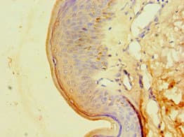 CA14 / Carbonic Anhydrase XIV Antibody