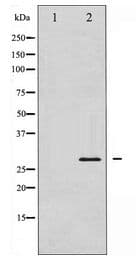 BCL2 / Bcl-2 Antibody