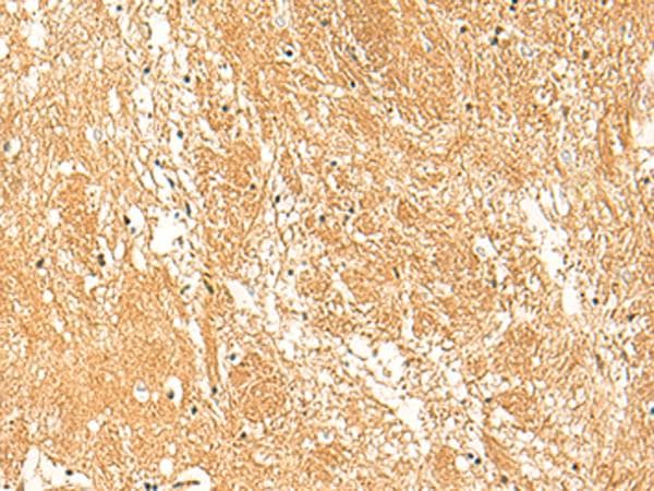STK32C / PKE Antibody