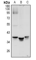 Polyclonal Rabbit anti-Human MRGX1 / MRGPRX1 Antibody (IF, WB)