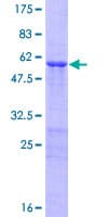 Human OVOL2 Protein (Recombinant GST)