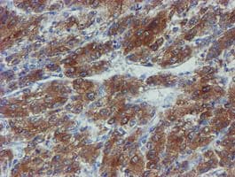 PPAT Antibody (aa42-278, clone OTI1B8)