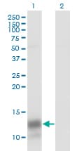 CXCL4 / PF4 Antibody (clone 3F6)