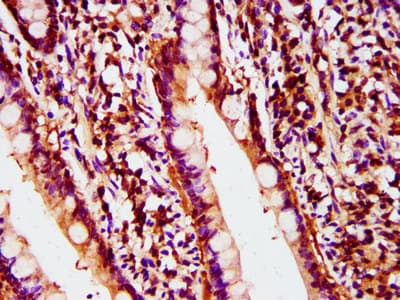 Polyclonal Rabbit anti-Human POLD2 Antibody (IHC)