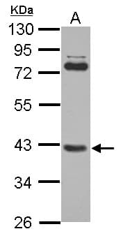 SMYD3 Antibody