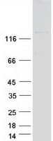 Human ABL2 Protein (Recombinant Myc-DDK (Flag))