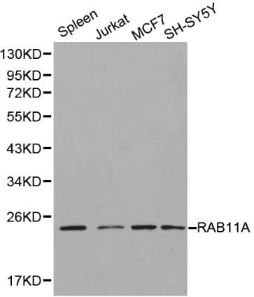 Polyclonal Rabbit anti-Human RAB11A Antibody (IHC, WB)