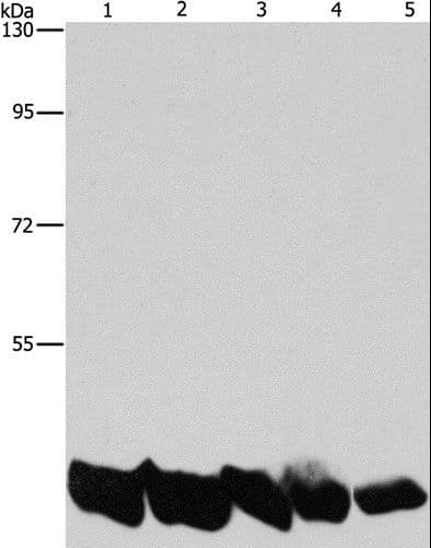 PGK1 / Phosphoglycerate Kinase Antibody