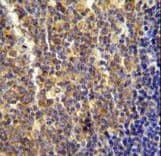 LYRM4 Antibody (aa43-69)