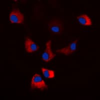 Polyclonal Rabbit anti-Human Protein Kinase A (PKA) Catalytic Subunit Antibody (phospho-Thr198, IHC, IF, WB)