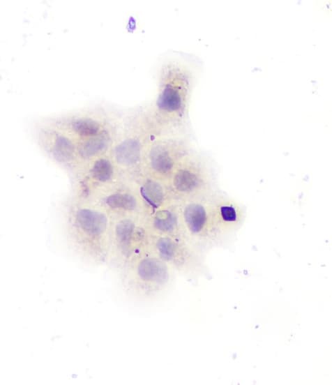 Polyclonal Rabbit anti-Human GAD1 / GAD67 Antibody (aa10-24, IHC, WB)