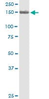 PKD2 / Polycystin 2 Antibody (clone 4C8)