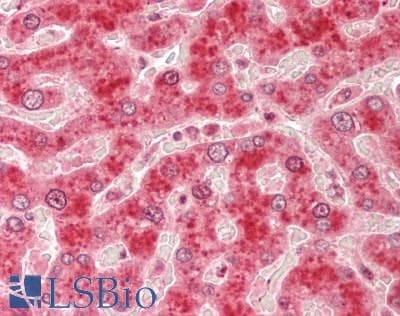 IHC-plus™ CYR61 Antibody (aa150-250)