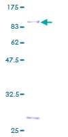 Human NAB1 Protein (Recombinant GST)