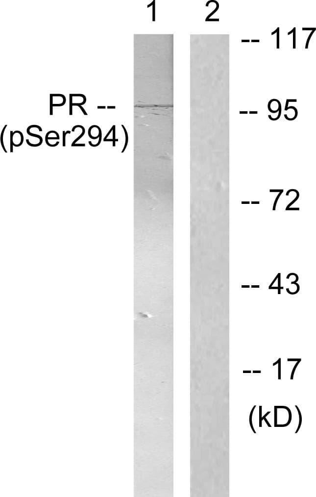PR / Progesterone Receptor Antibody (phospho-Ser294)