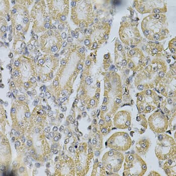 PDGF-BB Antibody