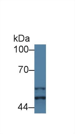 GSK3A / GSK3 Alpha Antibody (aa122-406)