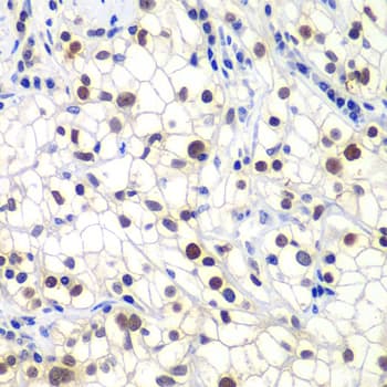 RAP30 / GTF2F2 Antibody