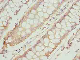 Polyclonal Rabbit anti-Human TTC30A Antibody (IHC, WB)