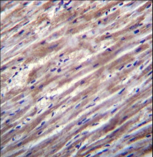 Polyclonal Rabbit anti-Human Dexras1 / RASD1 Antibody (aa248-277, IHC, WB)