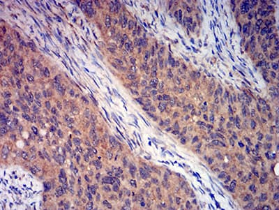 GRM3 / MGLUR3 Antibody (clone 7A5A6)