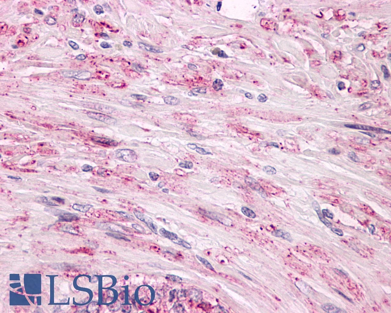IHC-plus™ ADGRL2 / LPHN2 Antibody (C-Terminus)