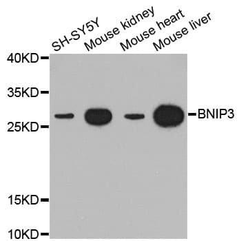 IHC-plus™ NIP3 / BNIP3 Antibody