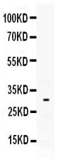 Polyclonal Rabbit anti-Human TPSAB1 / Mast Cell Tryptase Antibody (IHC, WB)