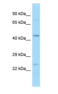 BFSP2 Antibody (aa161-210)