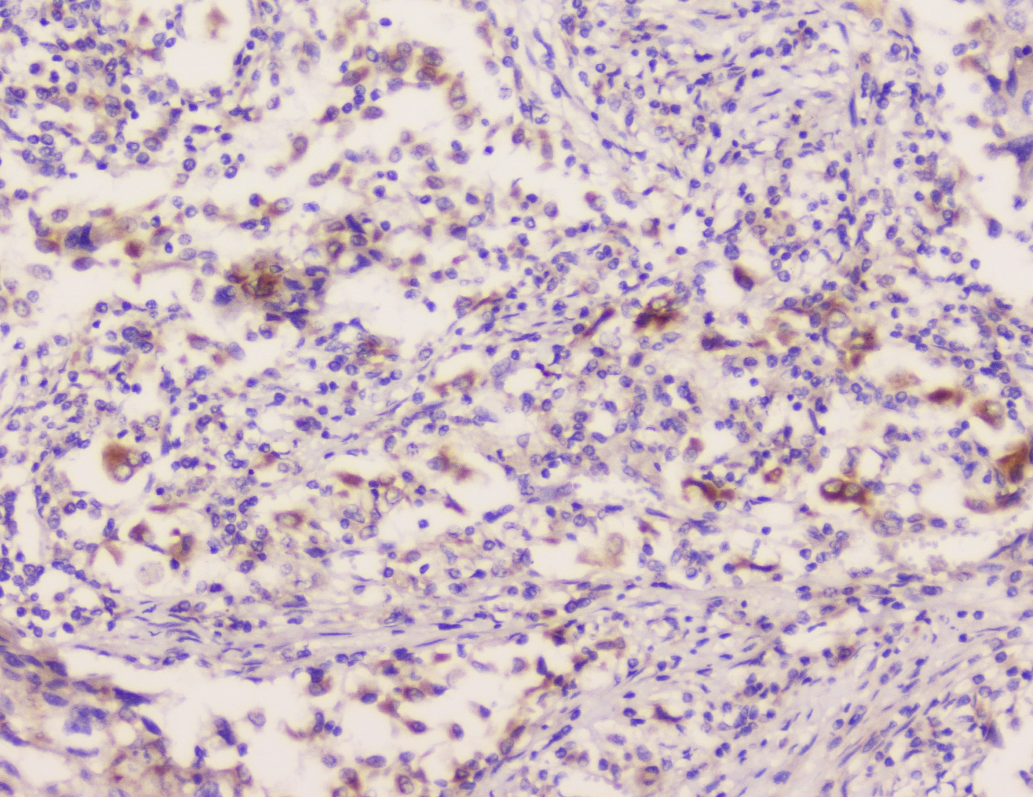 Polyclonal Rabbit anti-Human EML4 Antibody (IHC, WB)