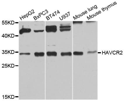 Polyclonal Rabbit anti-Human HAVCR2 / TIM-3 Antibody (aa22-202, IHC, WB)